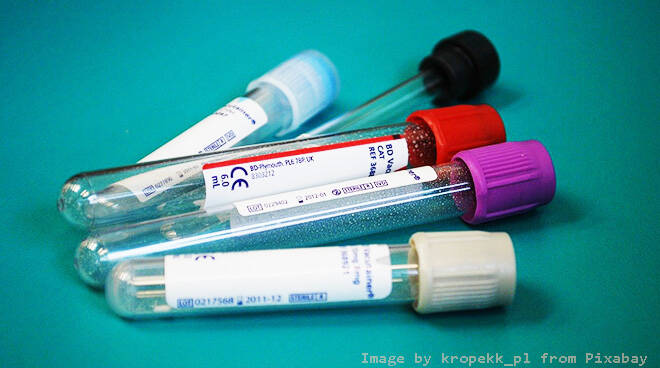 esami del sangue - Image by kropekk_pl from Pixabay 